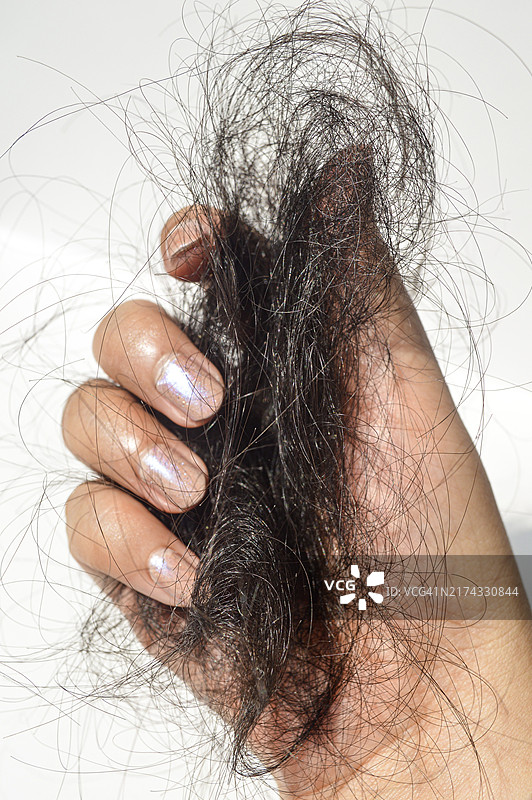 脱发，头发稀疏图片素材