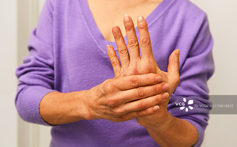 手部疼痛的年长女性图片素材