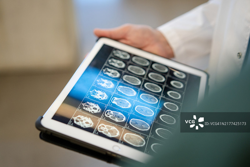 医生在数字平板上分析脑部MRI扫描的特写镜头图片素材