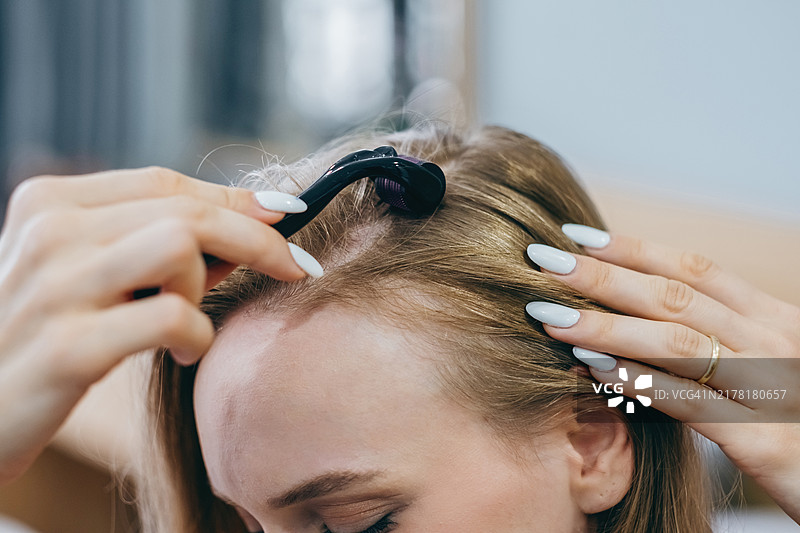 女人用微针滚轮护理发际线特写。头皮健康和毛囊刺激。图片素材