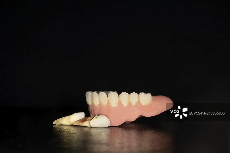 塑料上颌义齿（拔牙），黑色背景图片素材