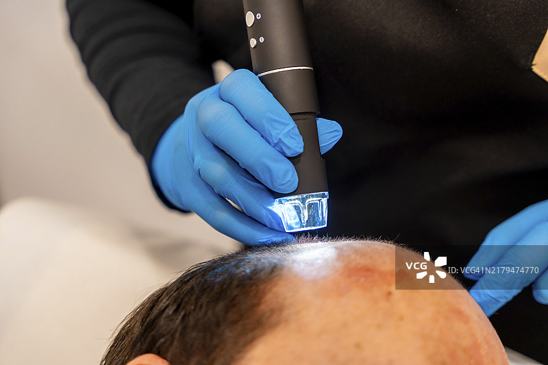 男子在水疗中心接受激光脱发治疗头部特写图片素材