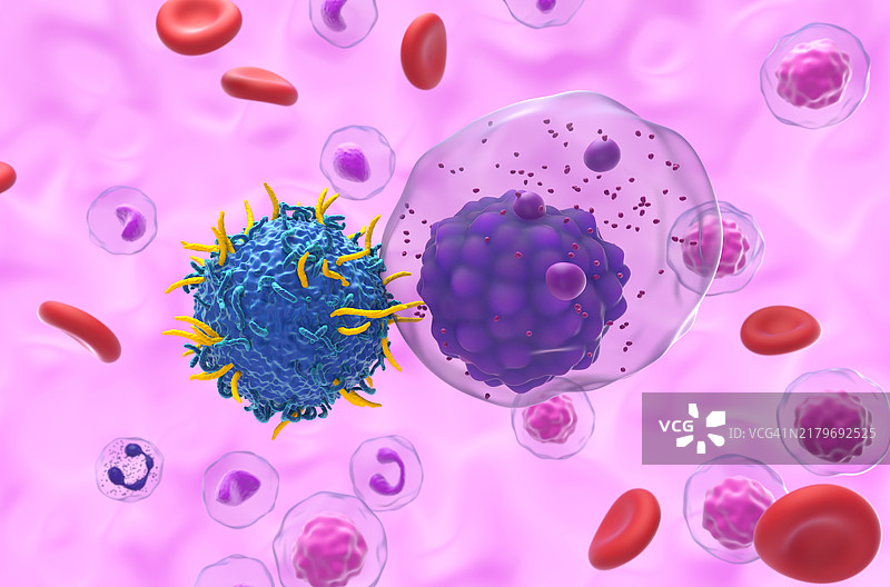 多发性骨髓瘤CAR-T细胞疗法，图示图片素材
