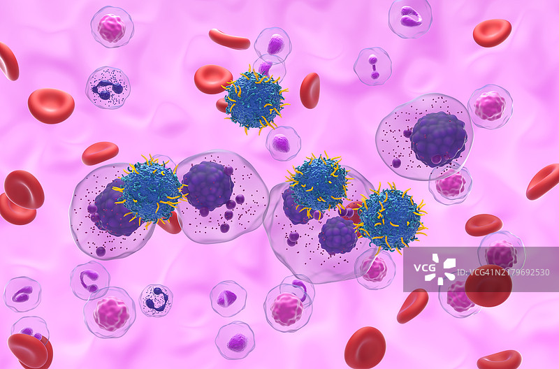 多发性骨髓瘤CAR-T细胞疗法，图示图片素材