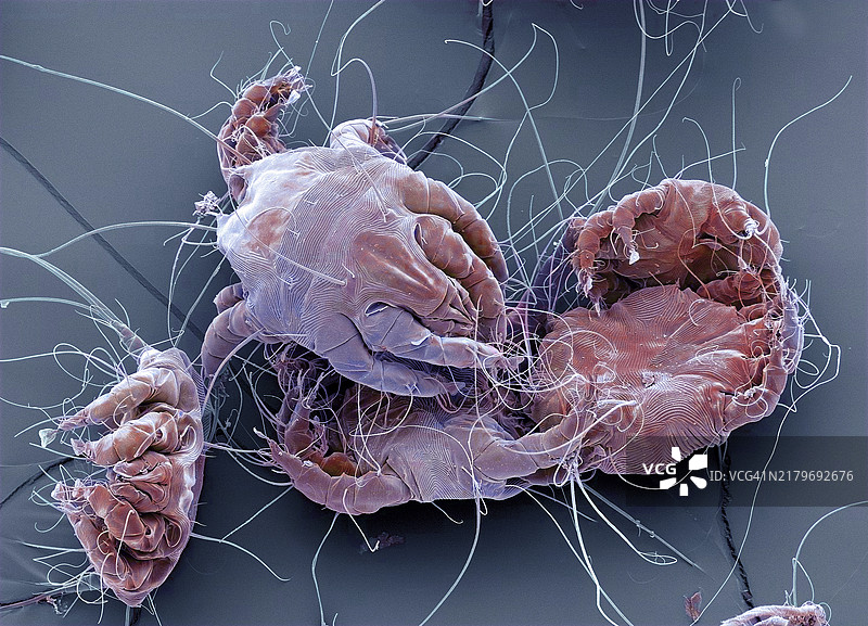 尘螨扫描电镜图图片素材
