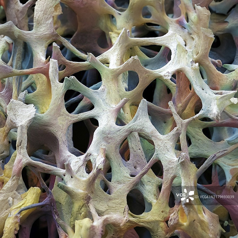 骨组织扫描电镜图图片素材