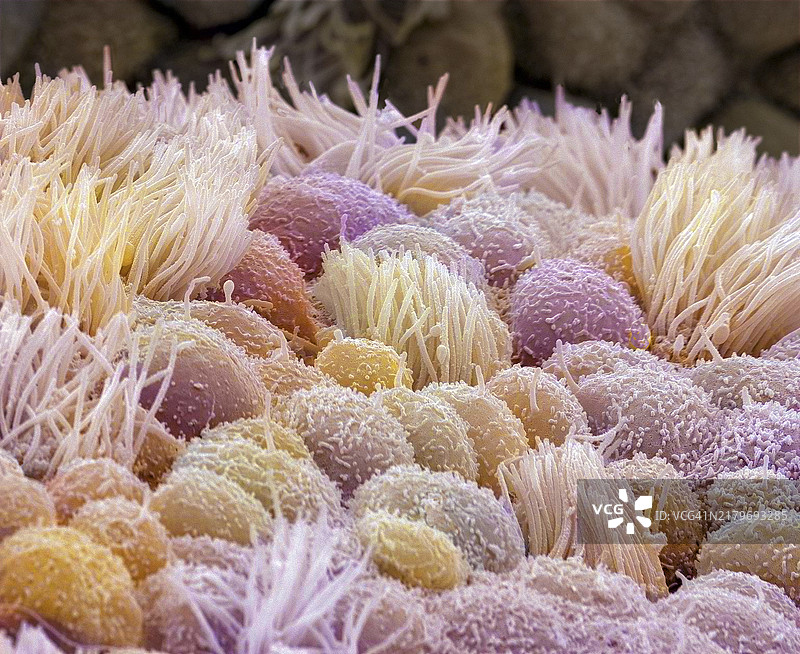 子宫扫描电镜图图片素材