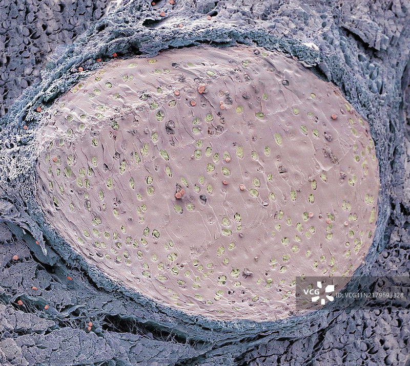 肋骨骨折扫描电镜图图片素材