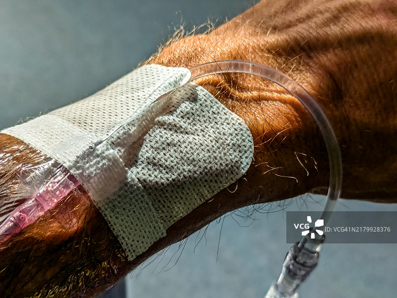 插入男人手腕的导管特写图片素材
