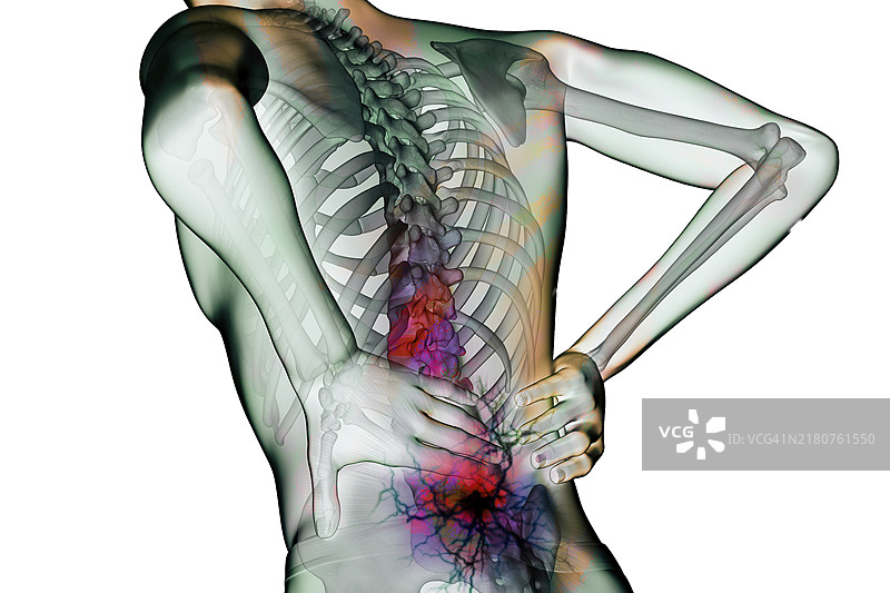 背痛是一种常见病，尤其由久坐行为引起图片素材