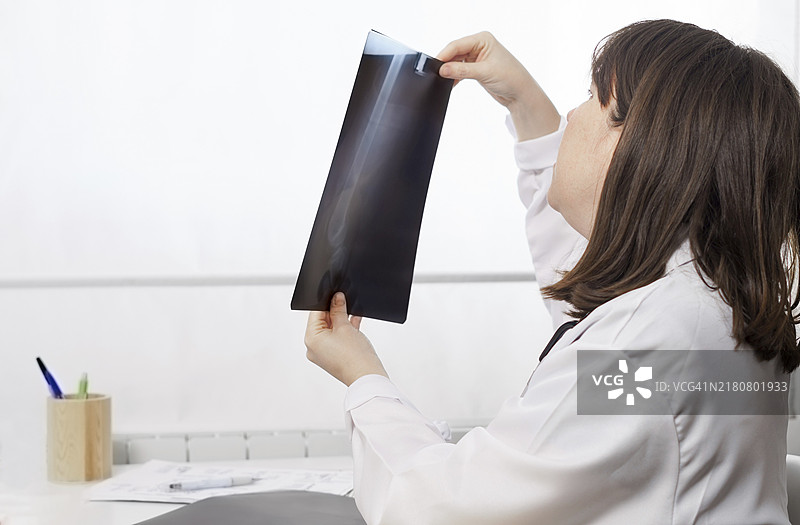 年轻女医生查看病人X光片（白色背景）图片素材