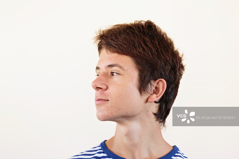 有皮肤问题的少年肖像图片素材