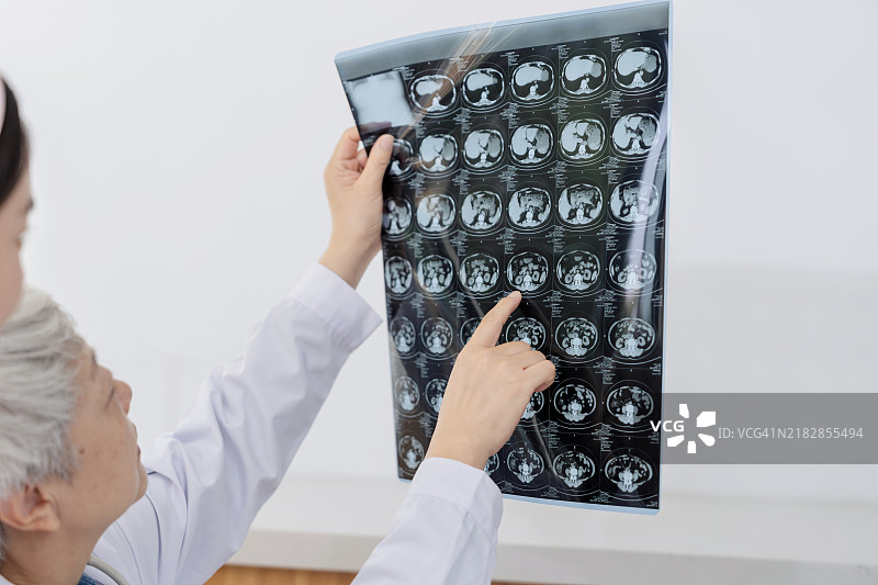 亚洲肾脏医学专家在现代透析中心与她的医疗团队讨论X光结果。图片素材