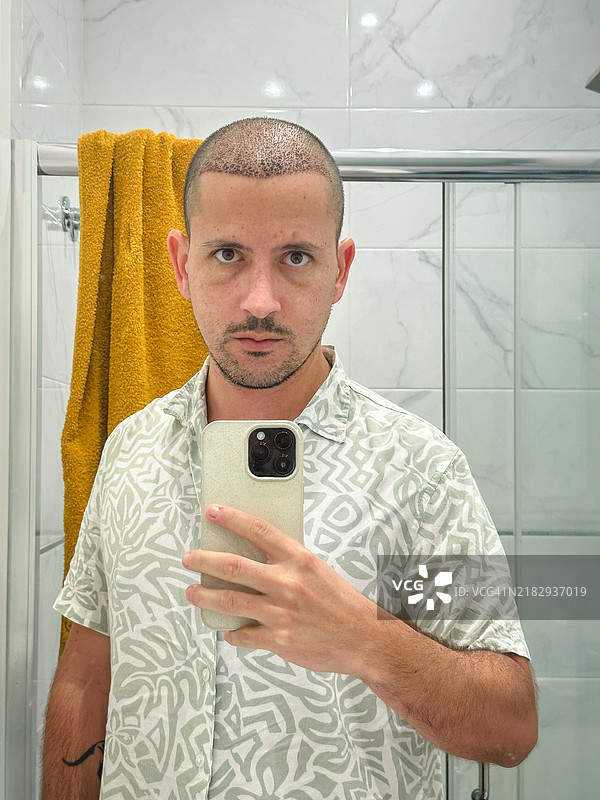 男性在植发后9天的自拍照图片素材
