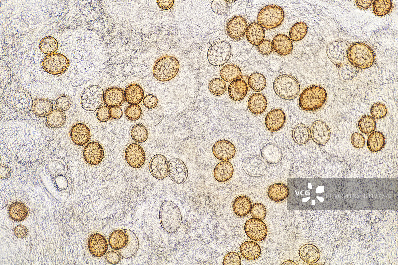 春季松露，白松露（Tuber borchii）孢子图片素材