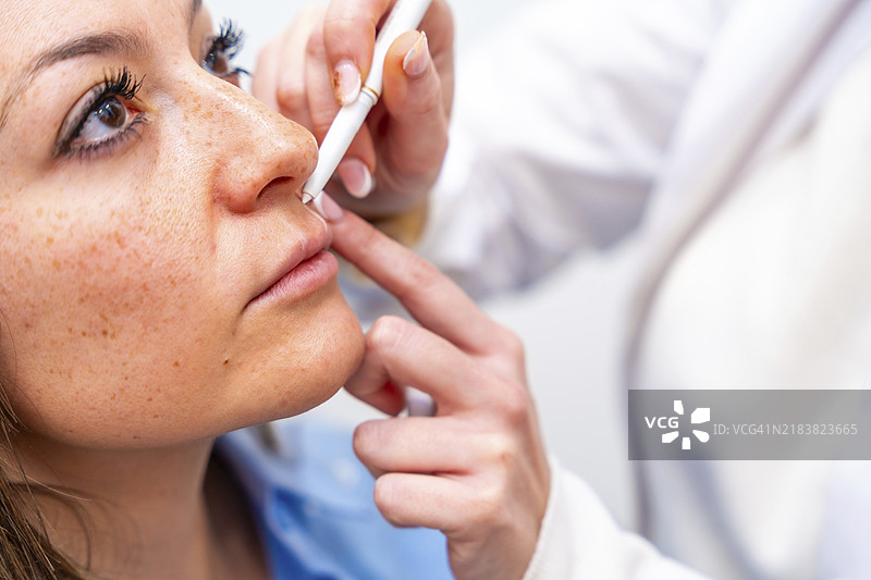 美容师在诊所用记号笔标记患者面部注射透明质酸的点，特写镜头。图片素材