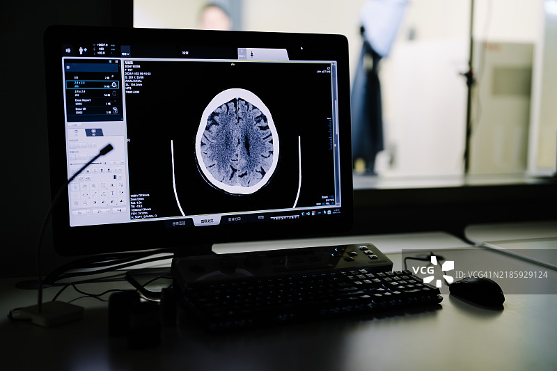 医院CT扫描仪。分析医院中的X光或扫描放射影像。图片素材