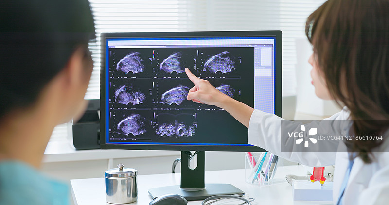 医生为女性解释子宫超声检查图片素材