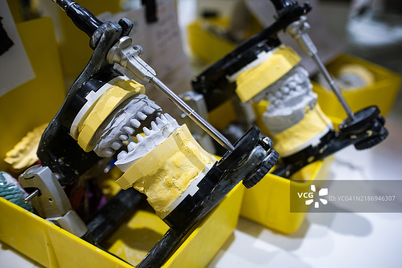 一个新的牙齿模型在石膏模具上进行测量。图片素材