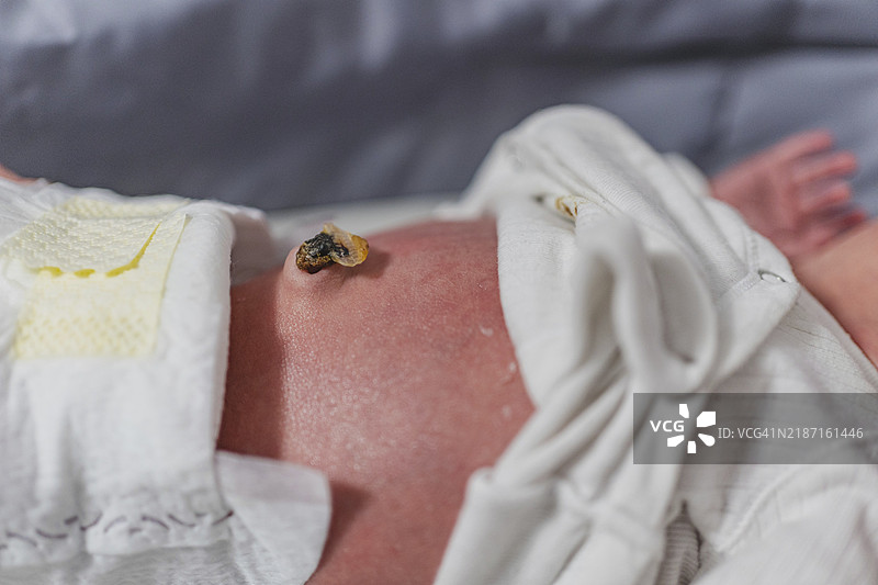 新生儿脐带特写。婴儿皮肤发红。图片素材