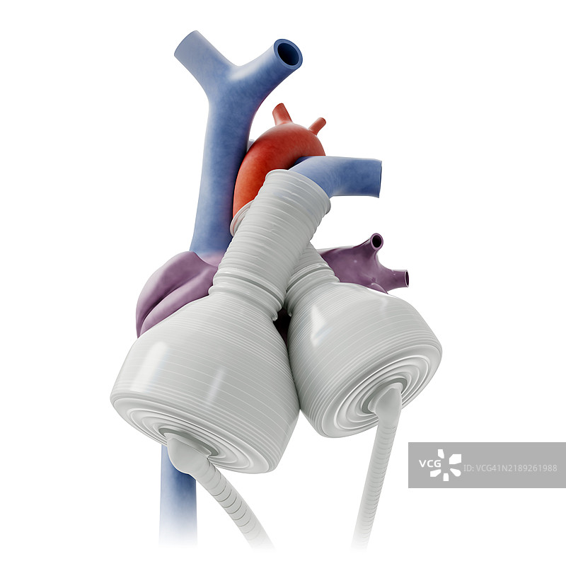 人工心脏结构插图图片素材