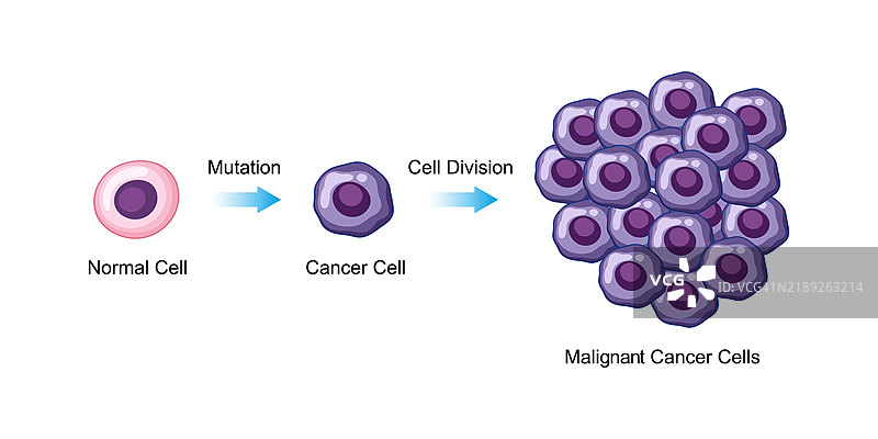 癌症发展插图图片素材