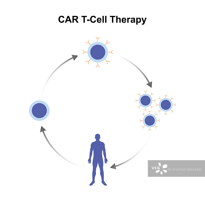 CAR-T细胞疗法插图图片素材