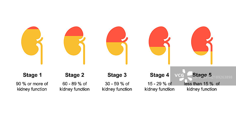 慢性肾病分期插图图片素材