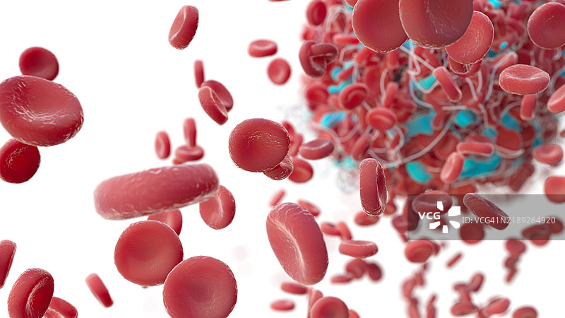 血栓插图图片素材