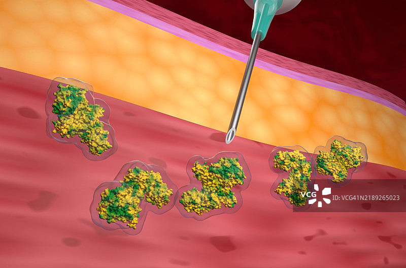 肉毒杆菌注射插图图片素材