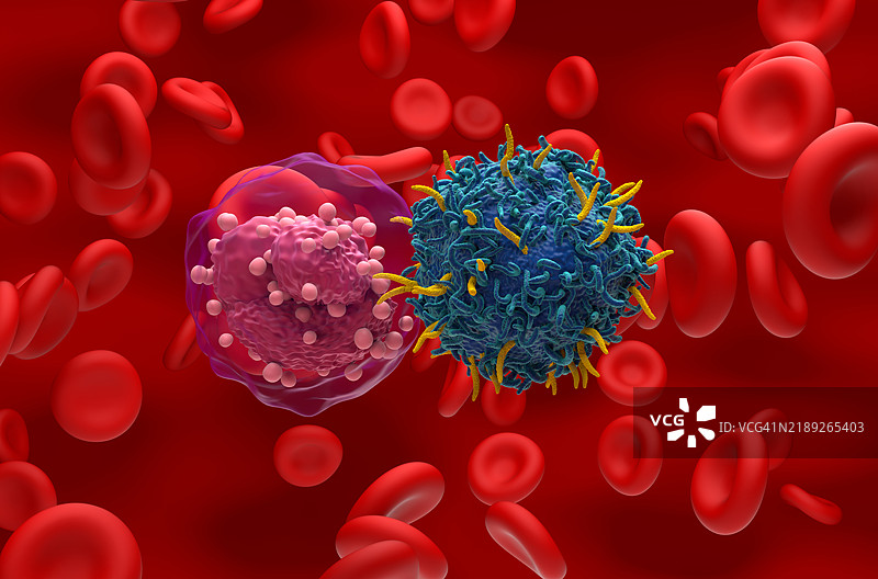 急性淋巴细胞白血病的CAR-T细胞疗法插图图片素材