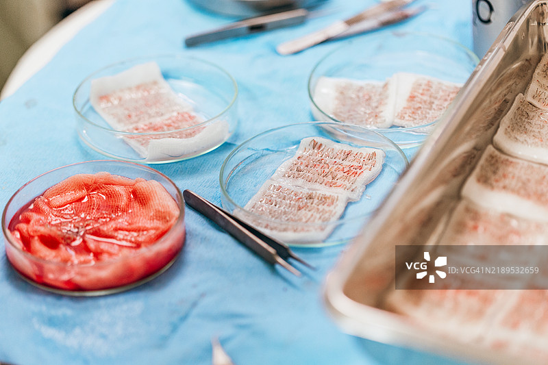 毛发移植手术 - FUE（毛囊单位提取）中的移植单位分离与准备。图片素材