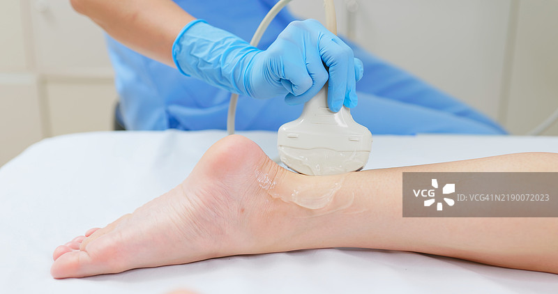 女性踝部损伤超声检查图片素材