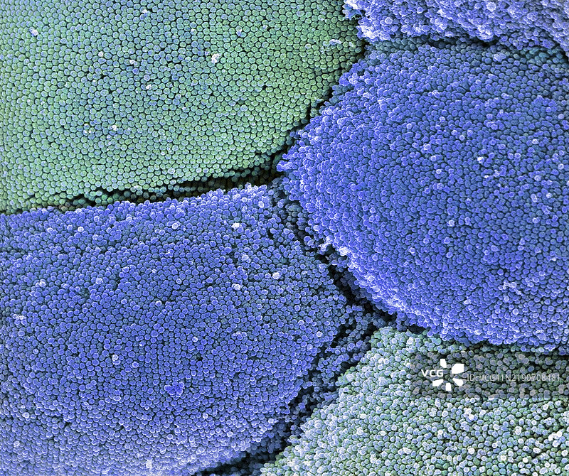 肠道微绒毛，扫描电子显微镜图像图片素材