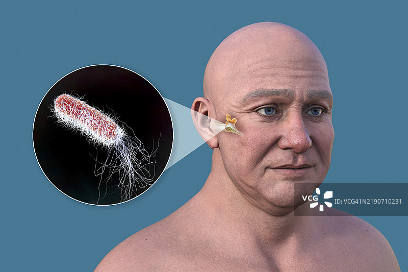 男性中耳炎插图图片素材