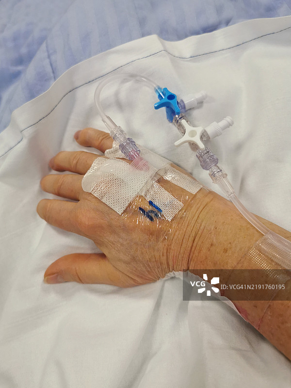手背上的输液图片素材