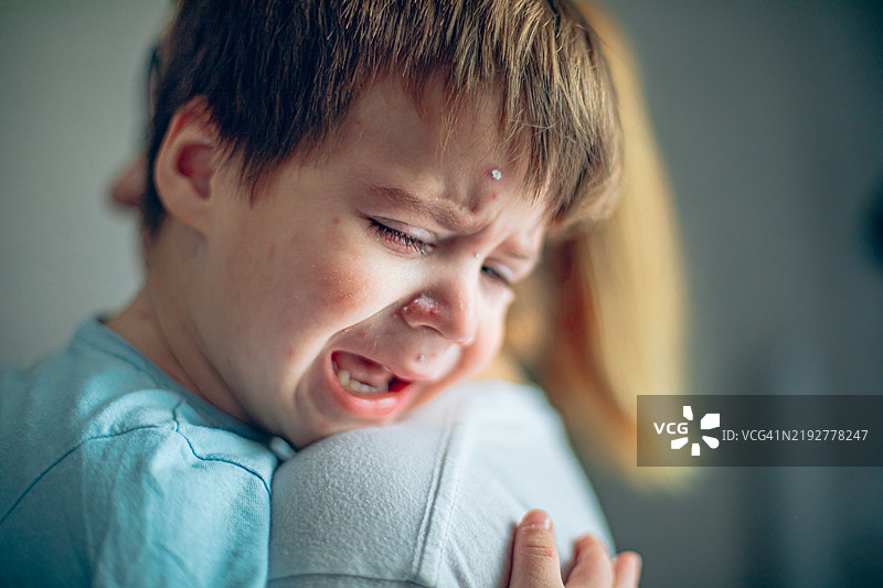 小男孩因水痘在妈妈的肩膀上哭泣图片素材