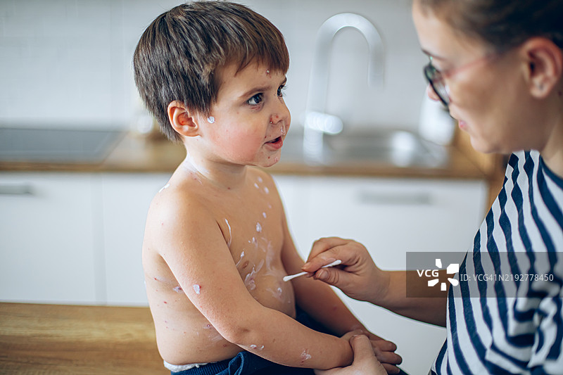 母亲在家给得水痘的小男孩涂抹消毒药水图片素材