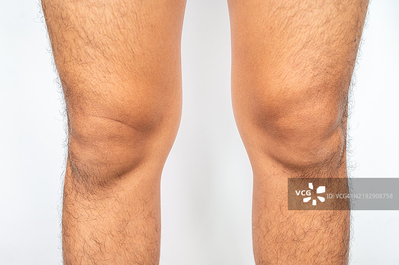 白色背景下男性腿部的特写，腿毛凌乱。腿毛是生长在人体腿部的毛发，通常在青春期开始后出现。图片素材