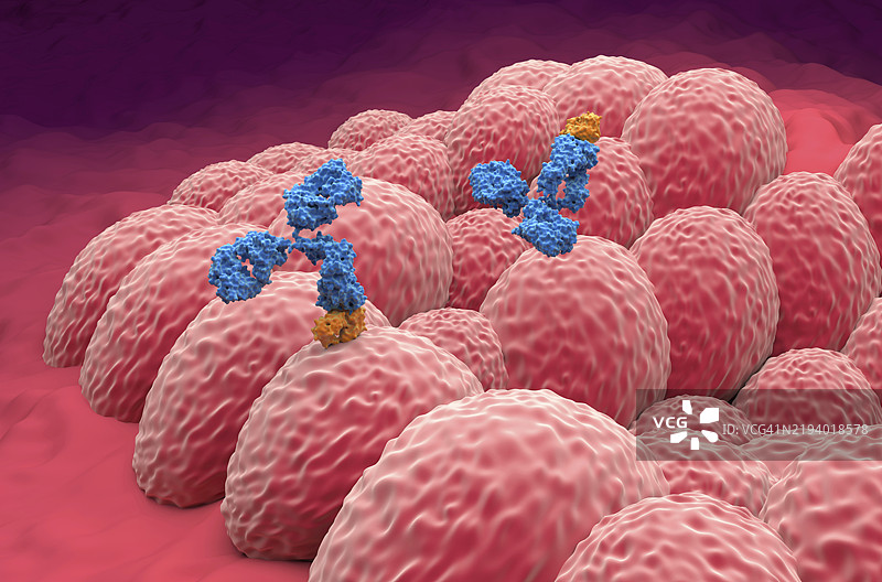 子宫内膜癌的单克隆抗体治疗插图图片素材