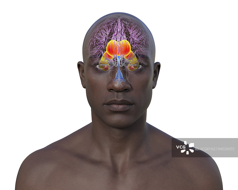 脑部侧脑室扩大，插图图片素材