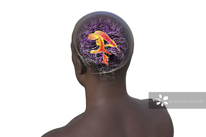 大脑的脑室系统插图图片素材