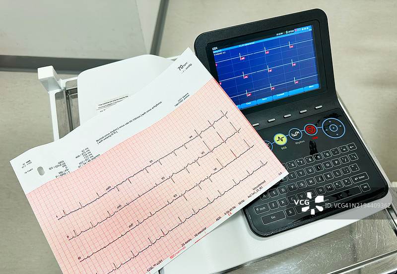 带有痕迹读数的血压计。图片素材