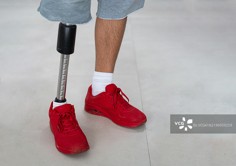 穿着短裤的截肢者，配有假肢腿图片素材