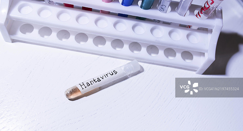 标有汉坦病毒的试管放置在实验室的架子旁边图片素材