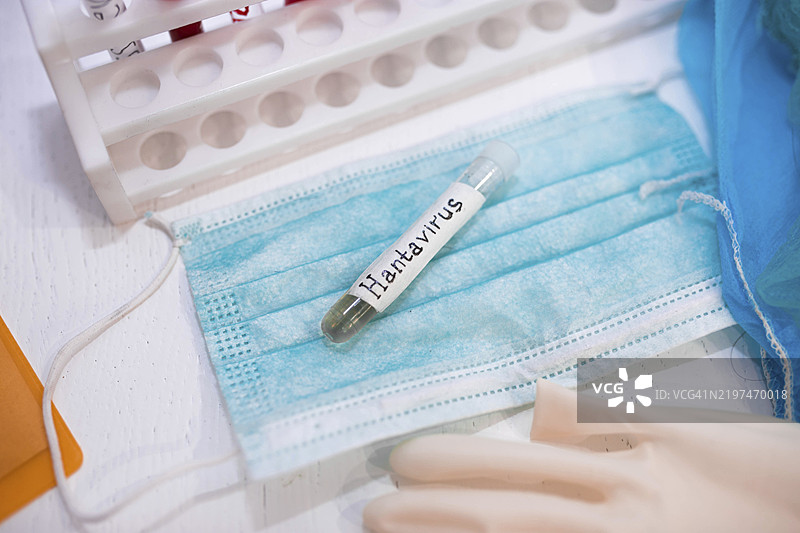 实验室环境中，带有汉坦病毒标签的试管、口罩和手套图片素材