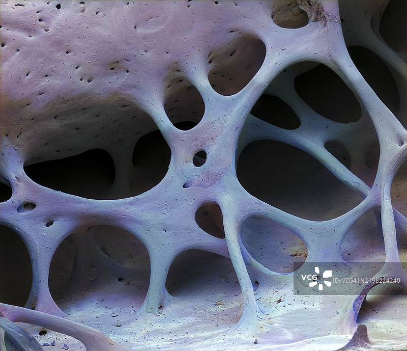 鸟骨，扫描电子显微镜图像图片素材