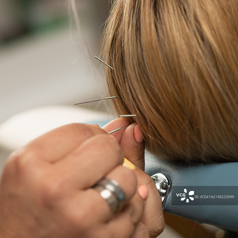 针灸师将针刺入松散的疏松结缔组织中图片素材