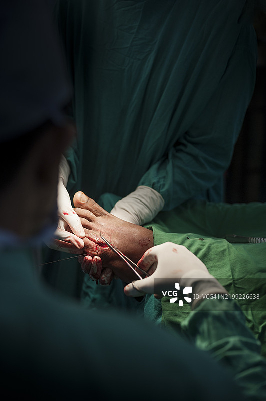 受伤的脚图片素材