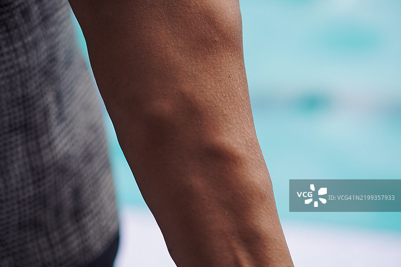 人手臂特写，展示静脉曲张和血管纹理图片素材